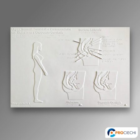 Contraccezione con diaframma e cappuccio cervicale